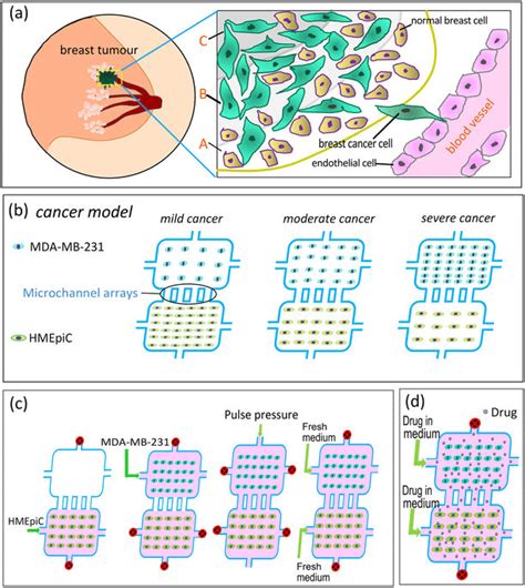 Schematic Illustration Of The Metastatic Breast Tumour B Schematic