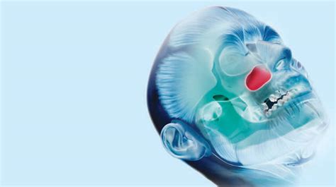 Mapping The Maxillary Sinus Decisions In Dentistry