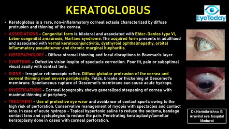 Keratoglobus - EyeToday