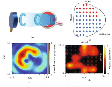 [pdf] Noninvasive Ultrasound Retinal Stimulation For Vision Restoration