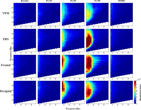 Phase Amplitude Coupling PAC Dynamics In Comodulograms The