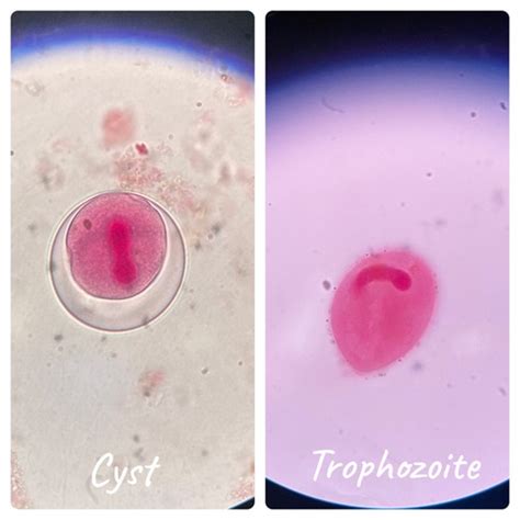 Final Exam Micro Bio Protozoa Flashcards Quizlet