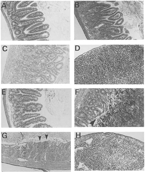 Histological Changes In The Ilea And Peyer S Patches Of Balb C And B