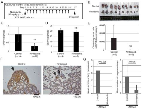 Singleagent Nintedanib Suppresses Metastatic Osteosarcoma Growth By