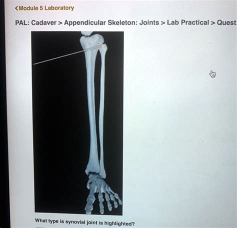 Solved Module Laboratory Cadaver Appendicular Skeleton Joints