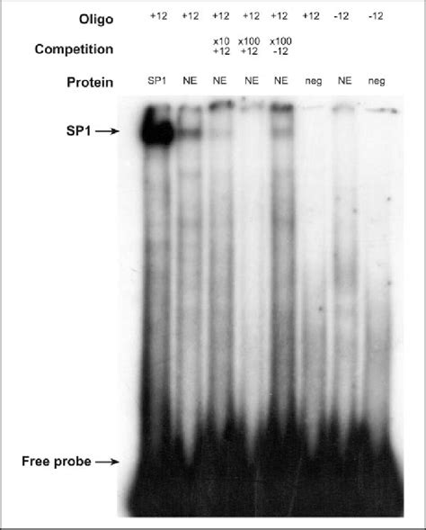 EMSA Analysis Of SP1 Binding To The PRNP Promoter Sequence 25 Fmol Of