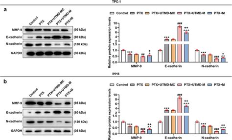 Full Article Ultrasound Targeted Microbubble Destruction Mediated MiR