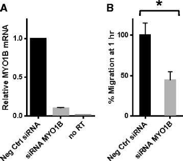 SiRNA Knockdown Of MYO1B Reduces Cell Migration In HPV Negative SCCHN