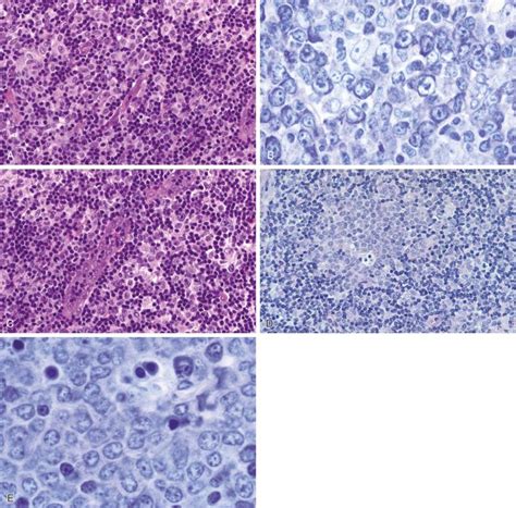 Normal Lymphoid Organs And Tissues Clinical Tree