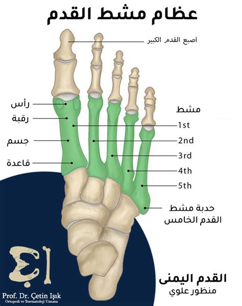 كسر مشط القدم من التشخيص إلى العلاج د شتين اشيك