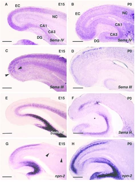 Expression Pattern Of Secreted Semaphorins And Their Receptor