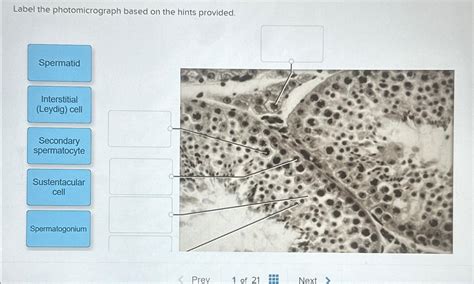 Solved Label The Photomicrograph Based On The Hints Chegg