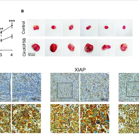 CircKIF5B Promotes Tumors Growth Through XIAP Signaling A