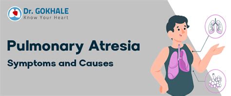 Pulmonary Atresia Symptoms and Causes | Dr Gokhale