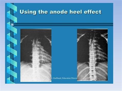 Anode heel effect, line focus principle, | PPT