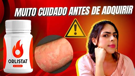 ORLISTAT CAPS Funciona Mesmo Orlistat Caps Emagrece YouTube