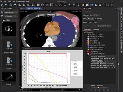 Weasis Dicom Medical Viewer Image Viewing Software