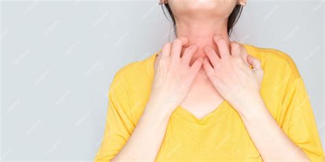 Corpo Empolado E Coçando - Mulher com sintomas de alergia coçando o pescoço ou pele seca e coçando ...