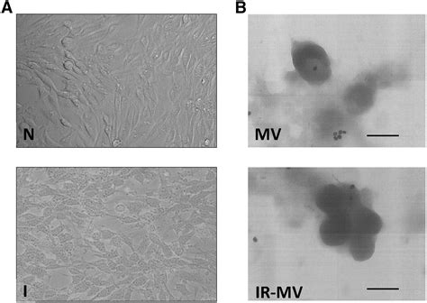 Malignant Glioma Therapy By Vaccination With Irradiated C Cell Derived