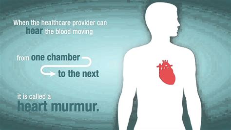 Heart Valve Problems And Causes American Heart Association