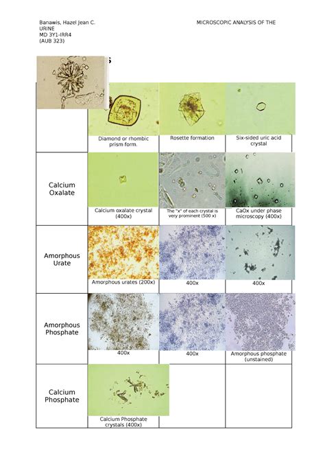 Urine Sediments Banawis Hazel Jean C URINE MD AUB 323 MICROSCOPIC