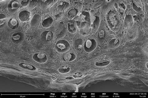 Visualizing Skin Tissue Morphology With Scanning Electron Microscopy