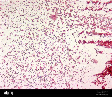 Acinetobacter Baumannii Gram Stain