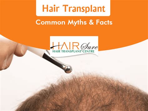 Hair Transplant Common Myths And Facts Hair Sure