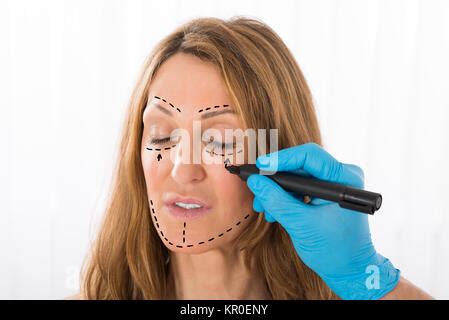 Surgeon Drawing Correction Lines On Woman Face Stock Photo Alamy