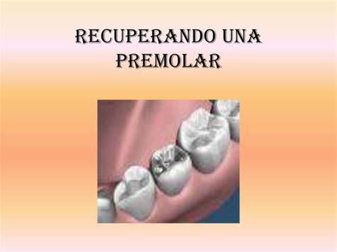 Curaciones Con Amalgama Y Resina Ppt