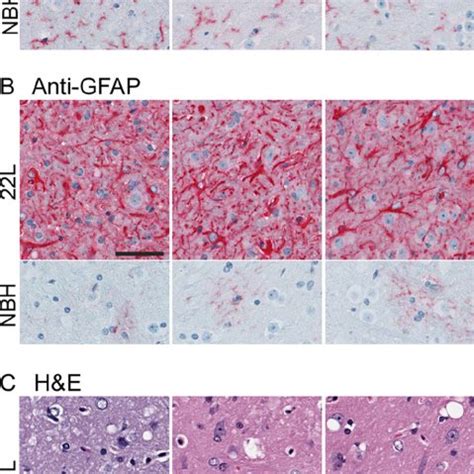 Early Detection Of PrPres In Scrapie Infected Brains A Immunoblot