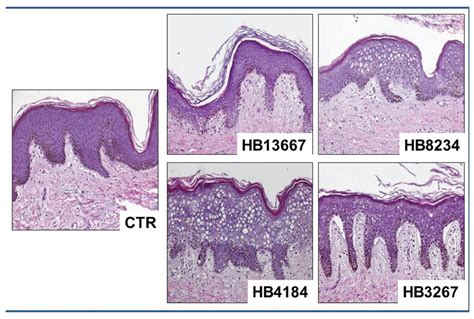 Frontiers Analysis Of The Pathogenic Potential Of Nosocomial