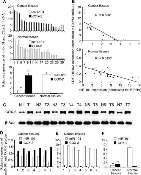 Downregulation Of MiR101 In Gastric Cancer Correlates With