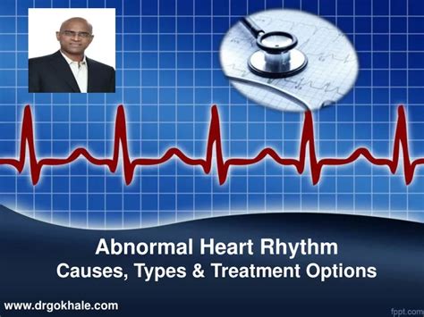 PPT - What is Abnormal Heart Rhythm | Causes, Types & Treatment Options ...