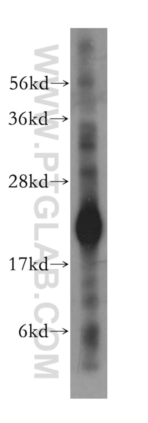 Cyb5b Rabbit Anti Human Mouse Rat Polyclonal Proteintech 150 μl