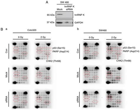 Analysis Of Intracellular Signaling Pathways A Sirna Knockdown Of