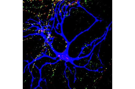 Trio Of Autism Linked Molecules Orchestrate Neuron Connections