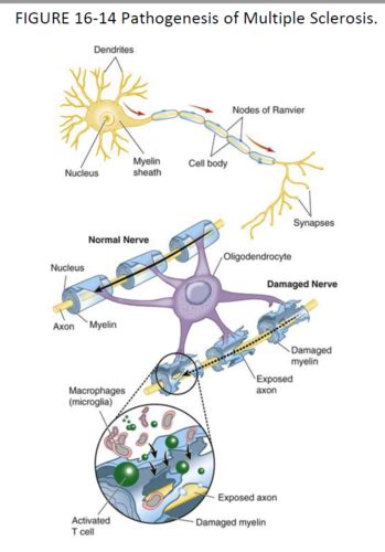 CNS Disorders 2 3 Flashcards Quizlet