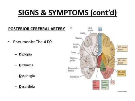ischaemic stroke overview