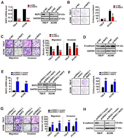 Nuf Promotes Ccrcc Cell Proliferation Migration And Invasion A E