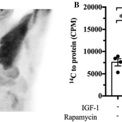 PKM2 And PKM1 2 Knockdown Do Not Decrease Proliferation Of Pancreatic