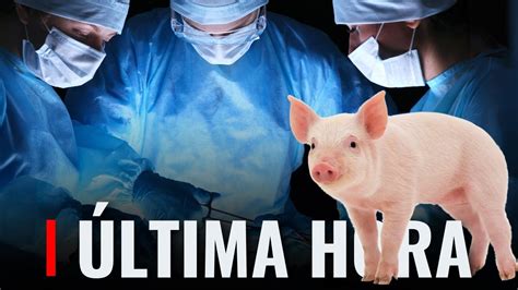 Historico Se Hace El Primer Transplante De Ri On De Cerdo A Humano