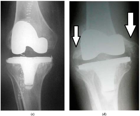 Ijms Free Full Text Recent Strategies To Combat Infections From