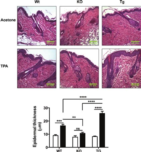 TPA Induced Epidermal Hyperplasia Is Impaired In RasGRP1 KO Mice Wt