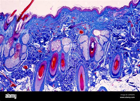 Sebaceous Gland Microscope Hi Res Stock Photography And Images Alamy