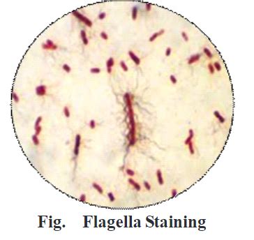 Flagella Staining: Principle, Procedure and Results - Biology Ease