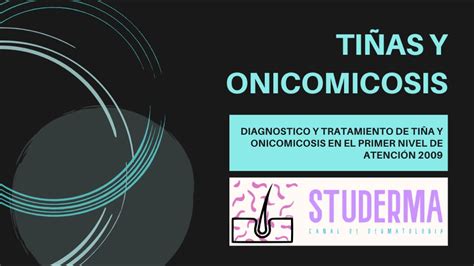 TiÑas Y Onicomicosis GuÍa De PrÁctica ClÍnica 2009 Studerma Youtube