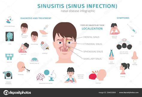 Symptoms Sinusitis Tranet Biologia Ufrj Br