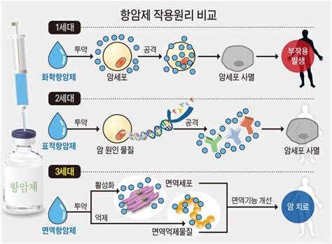 “면역항암제 간ㆍ뇌하수체 등에 염증 가능성” 한국일보