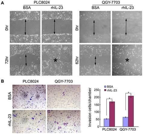 Il 23 Promotes Hcc Cell Migration And Invasion A Rhil 23 Treated Hcc